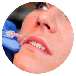 Harmonizção Facial