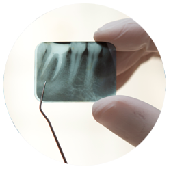 Endodontia